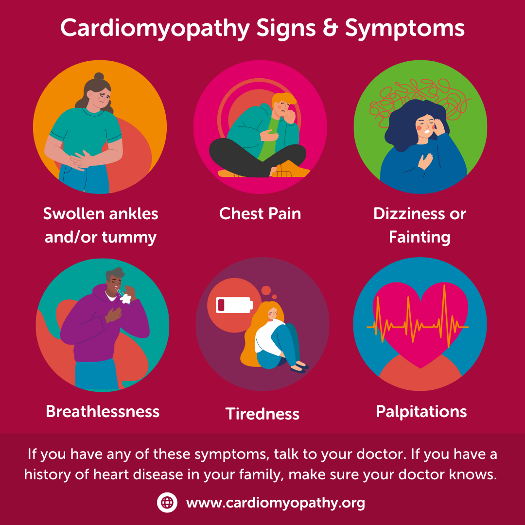 Cardiomyopathy 6 Signs and Symptoms